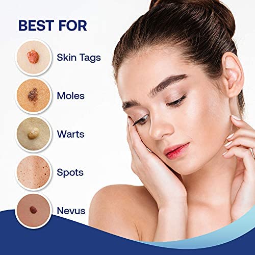 Medical Grade🏥2 IN 1 SKIN TAGS, MOLES AND WARTS Remover and Repair