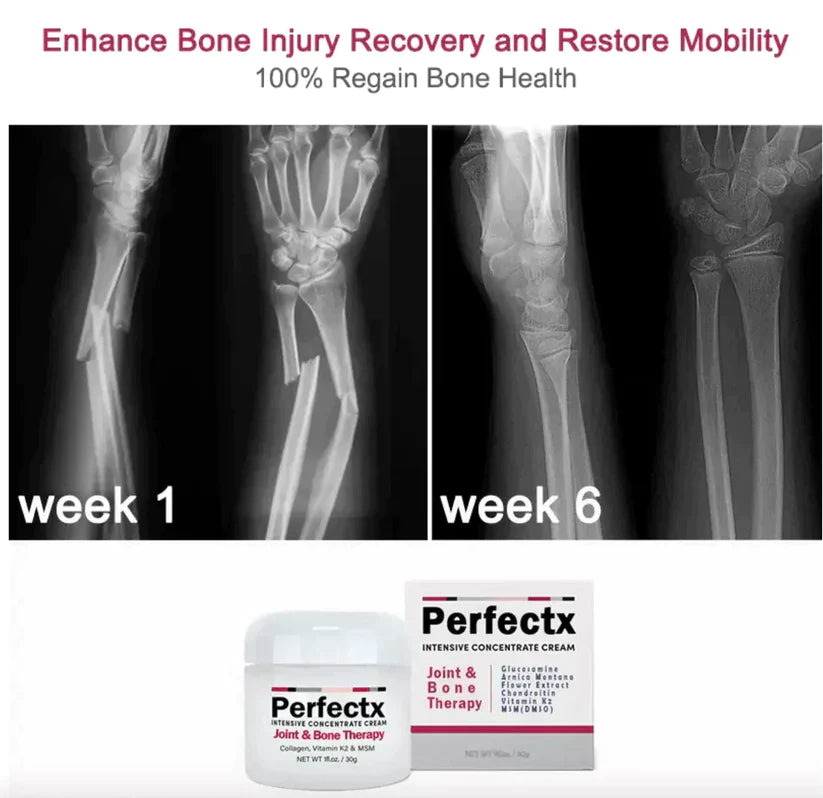 🔥LAST DAY Promotion 45% OFF🔥Perfectx™ Joint & Bone Therapy Cream