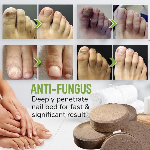 Anti-fungal Herbal Foot Soak