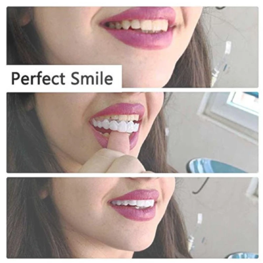 Magic Smile Teeth Brace 【Can eatting】100% non-inductive fit, no foreign body sensation！😁 (💥45% OFF) - 🔥HOT SALE🔥🎉