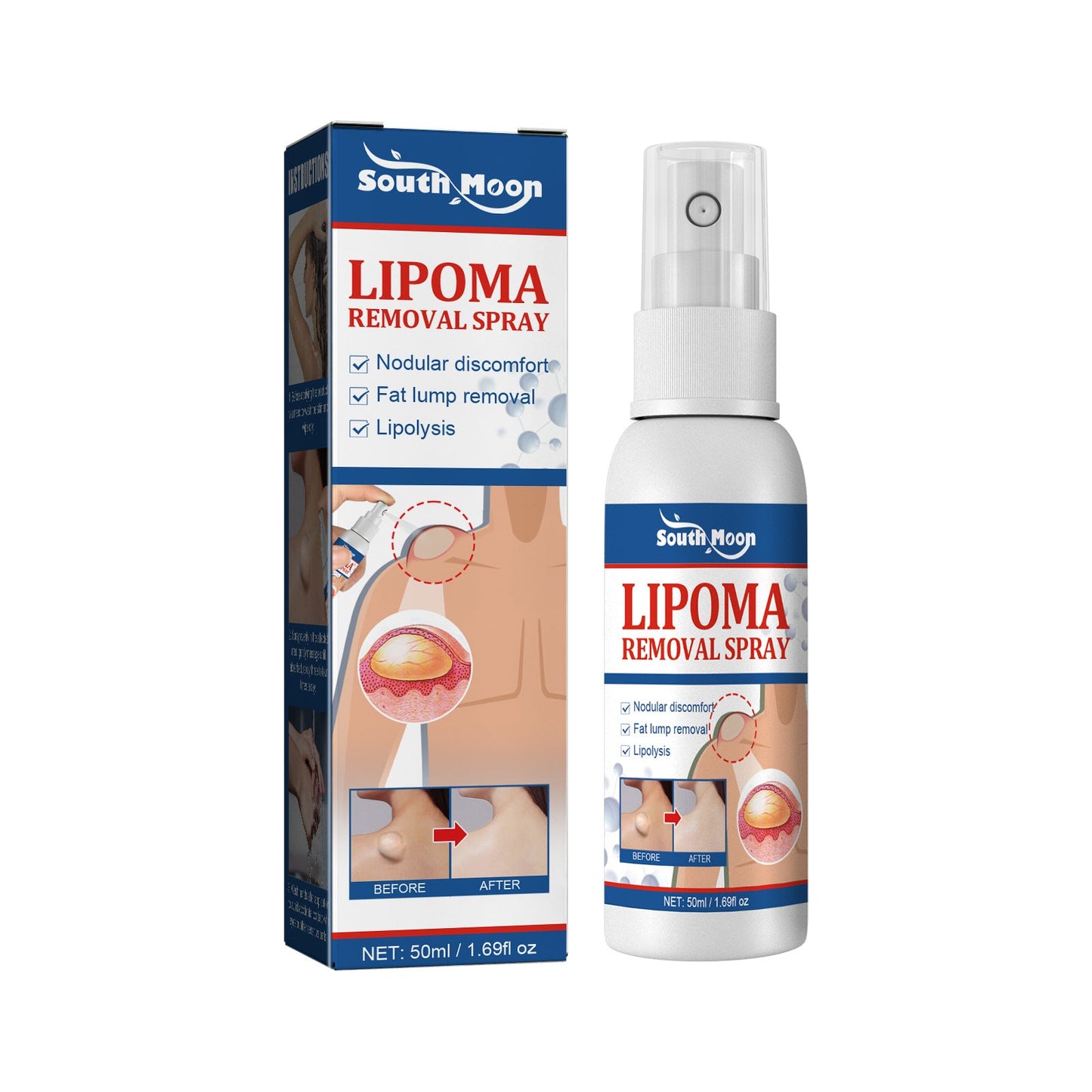 [south moon LIPOMA REMOVAL SPRAY] Relieves body fat lumps and subcutaneous fat nodules!!