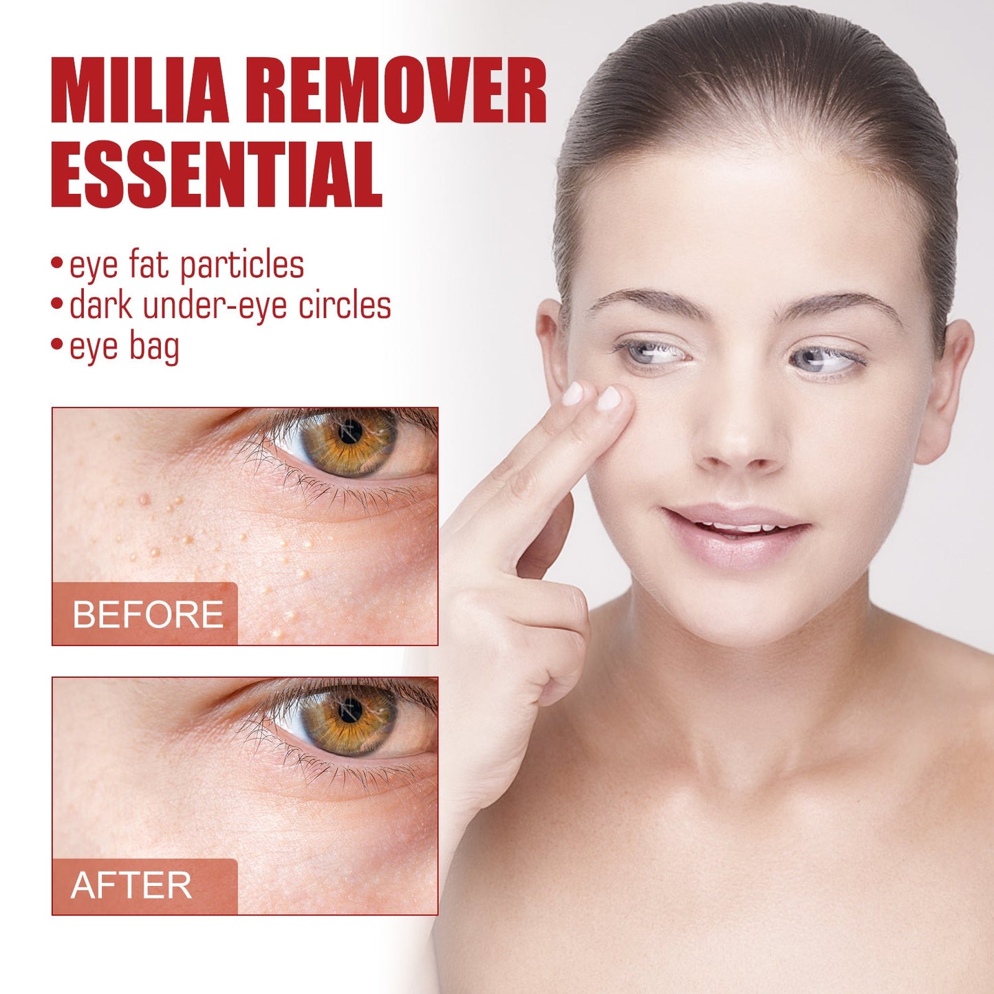 DermaPRO Rapid Milia Remover