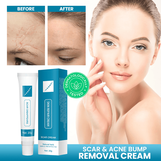 Scar & Acne Bump Removal Cream